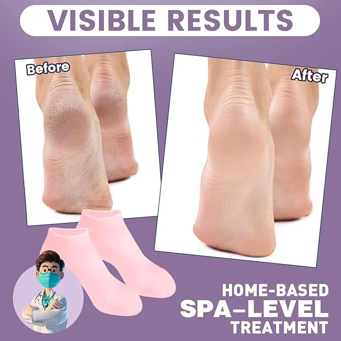 1 Pair Silicone Moisturizing Gel Heel Socks / Silicone Heel Pad For Foot Care / Multi-purpose